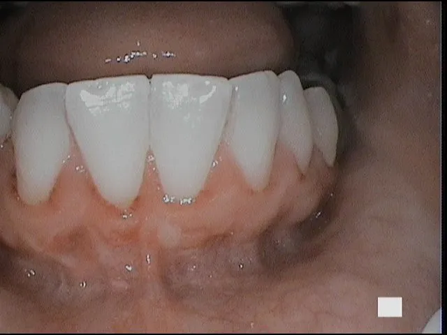 8a-#24 after